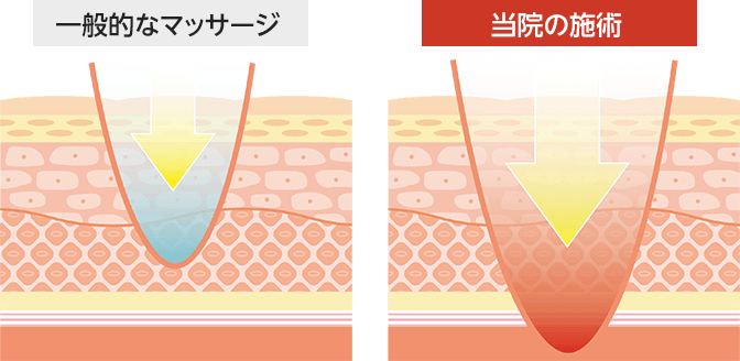 一般的なマッサージ、当院の施術